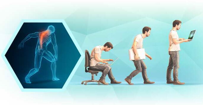 mala postura al trabajar frente a una computadora y osteocondrosis torácica