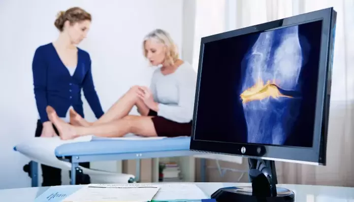 artrosis de la articulación en una mujer.