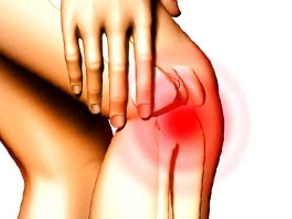 Dolor punzante en la rodilla causado por una lesión de menisco.