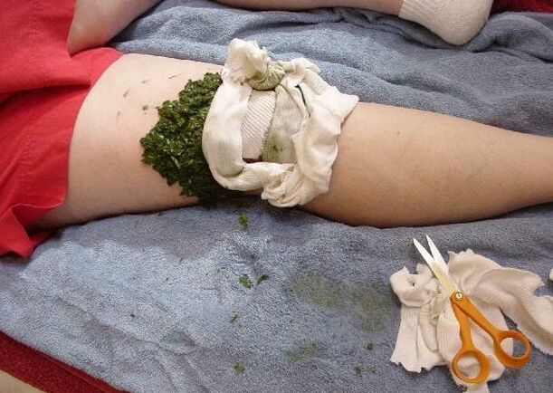 Tratamiento casero para la rodilla con compresa.