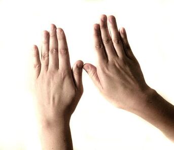 La mano humana tiene una estructura compleja y es susceptible al desarrollo de enfermedades.