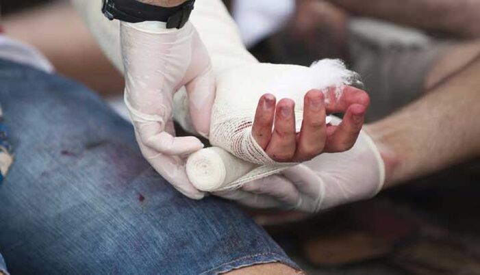 Lesión traumática en la mano acompañada de dolor en las articulaciones de los dedos.